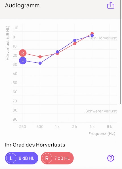 In which area do you have problems? The audiogram shows it.