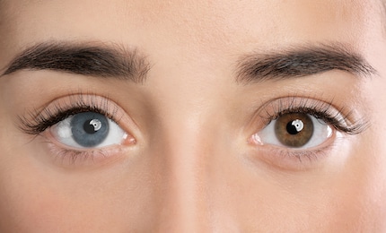 Two eyes, two colours: the melanin concentration is higher in the brown eye.