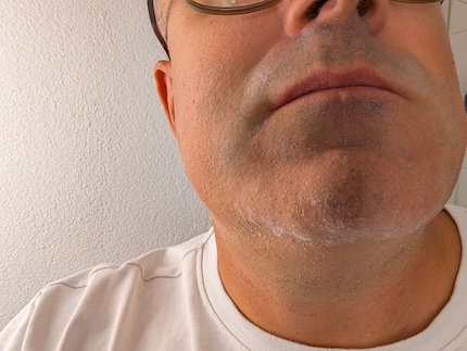Trockene Haut beim Trockenrasieren – für mich ist das nichts.